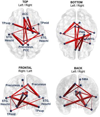 Frontiers Functional And Structural Network Recovery After Mild